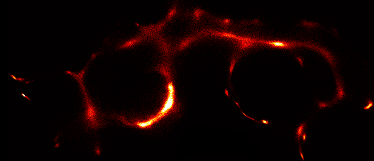 Sample 3B reconstruction of podosomes